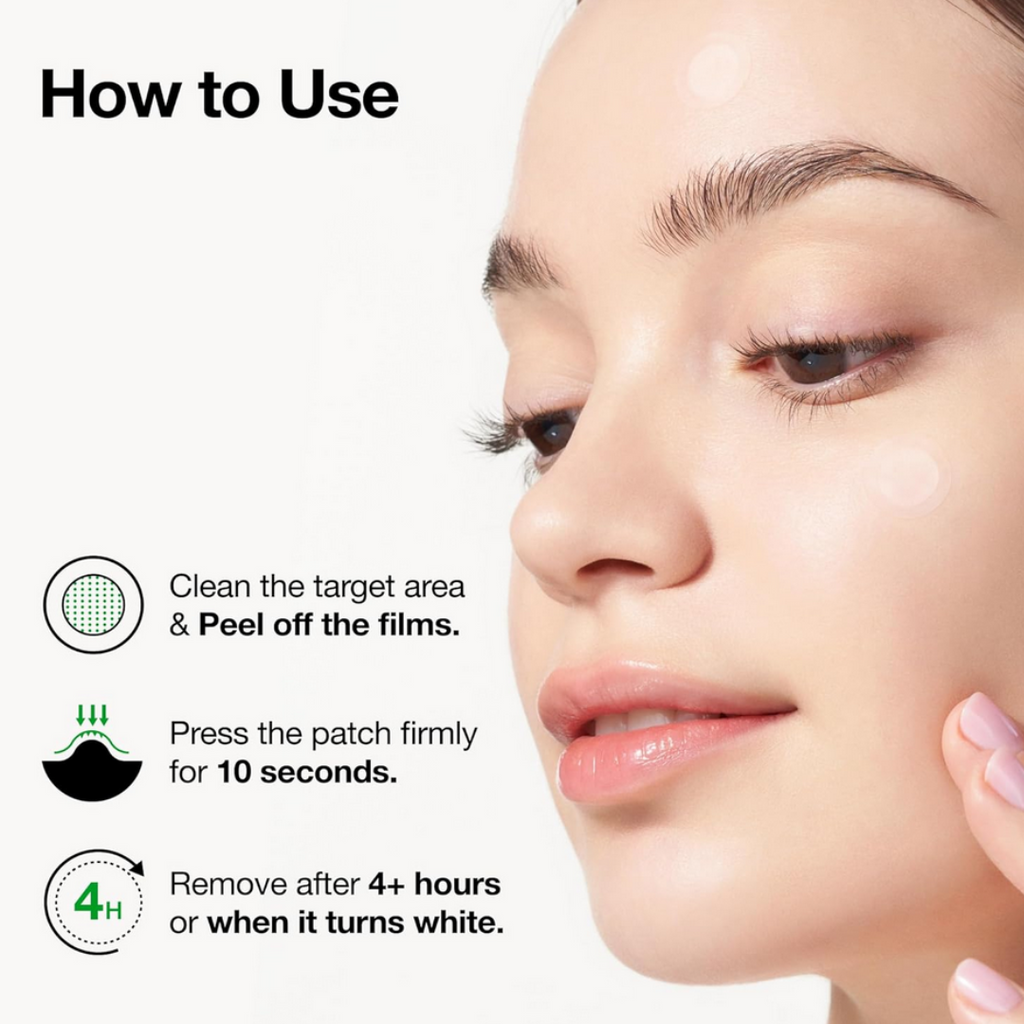 Auna Triple Acid Spot Care Microdart Patch 12 Pcs