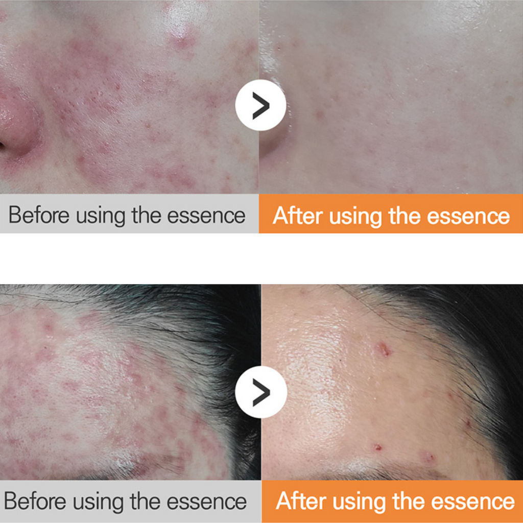 HYAAH Licorice First Essence 200ml