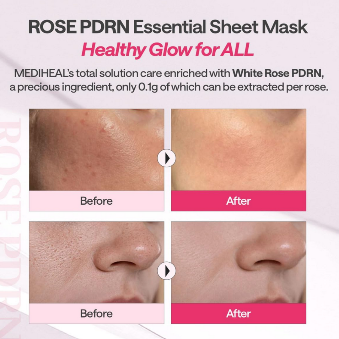 MEDIHEAL British White Rose PDRN Essential Mask Sheet Bio Emulsome 1 Pc
